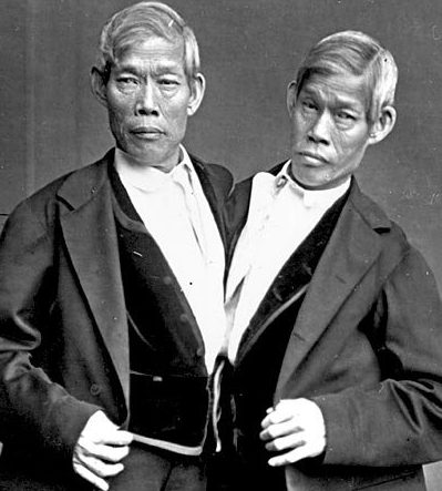 Cheng y Eng, los gemelos siameses