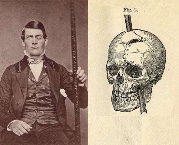 phineas-gage-01