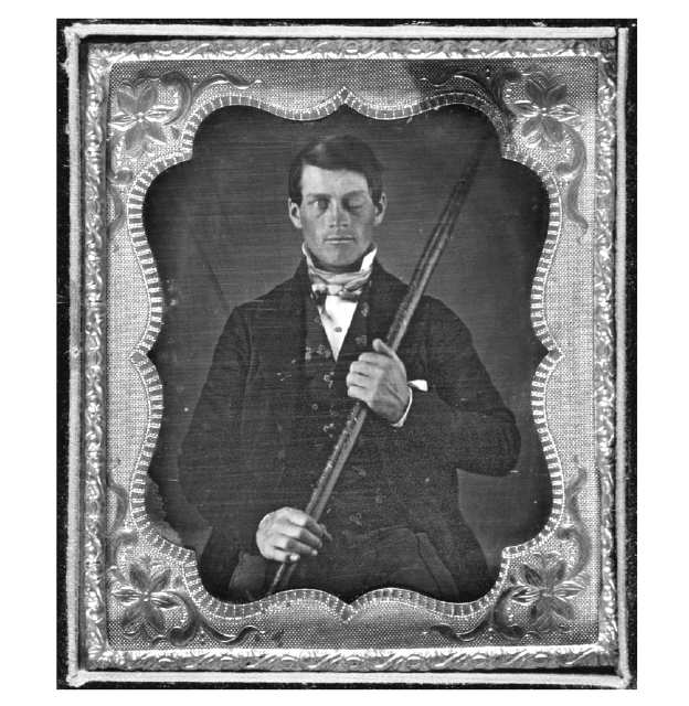 Phineas Gage 02