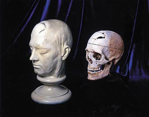 Cráneo de Phineas Gage y máscara de su rostro exhibidas en el Museo Anatómico de Warren